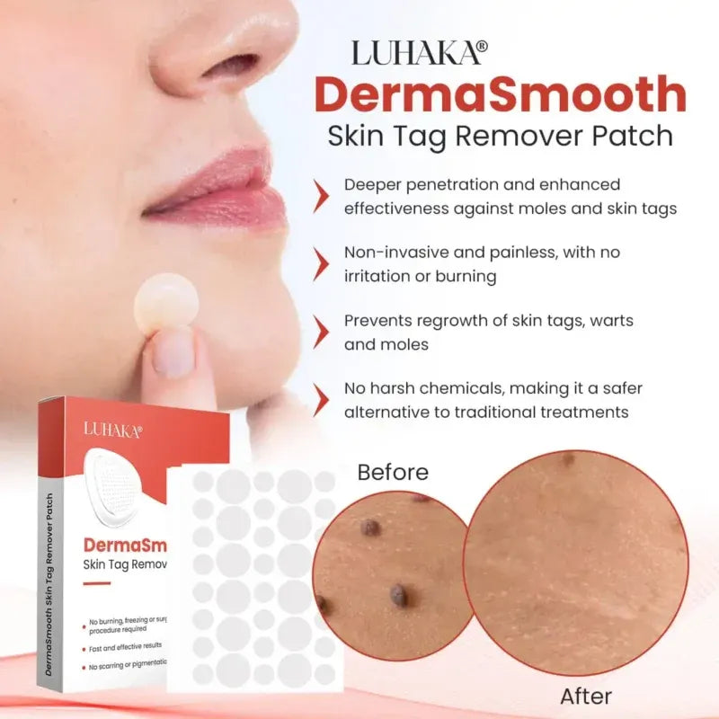 Derma Smooth Skin Tag Removal Patch | Secret to Spotless Skin